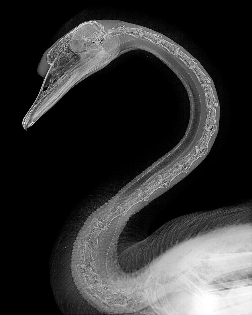 Swan, X-ray
