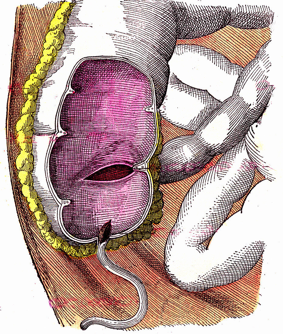 Caecum and appendix anatomy, 19th century