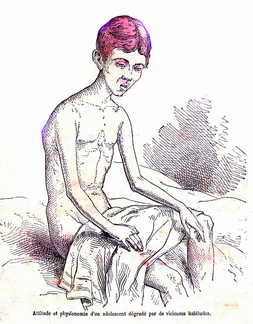 Anti-masturbation theory of disease, 19th century