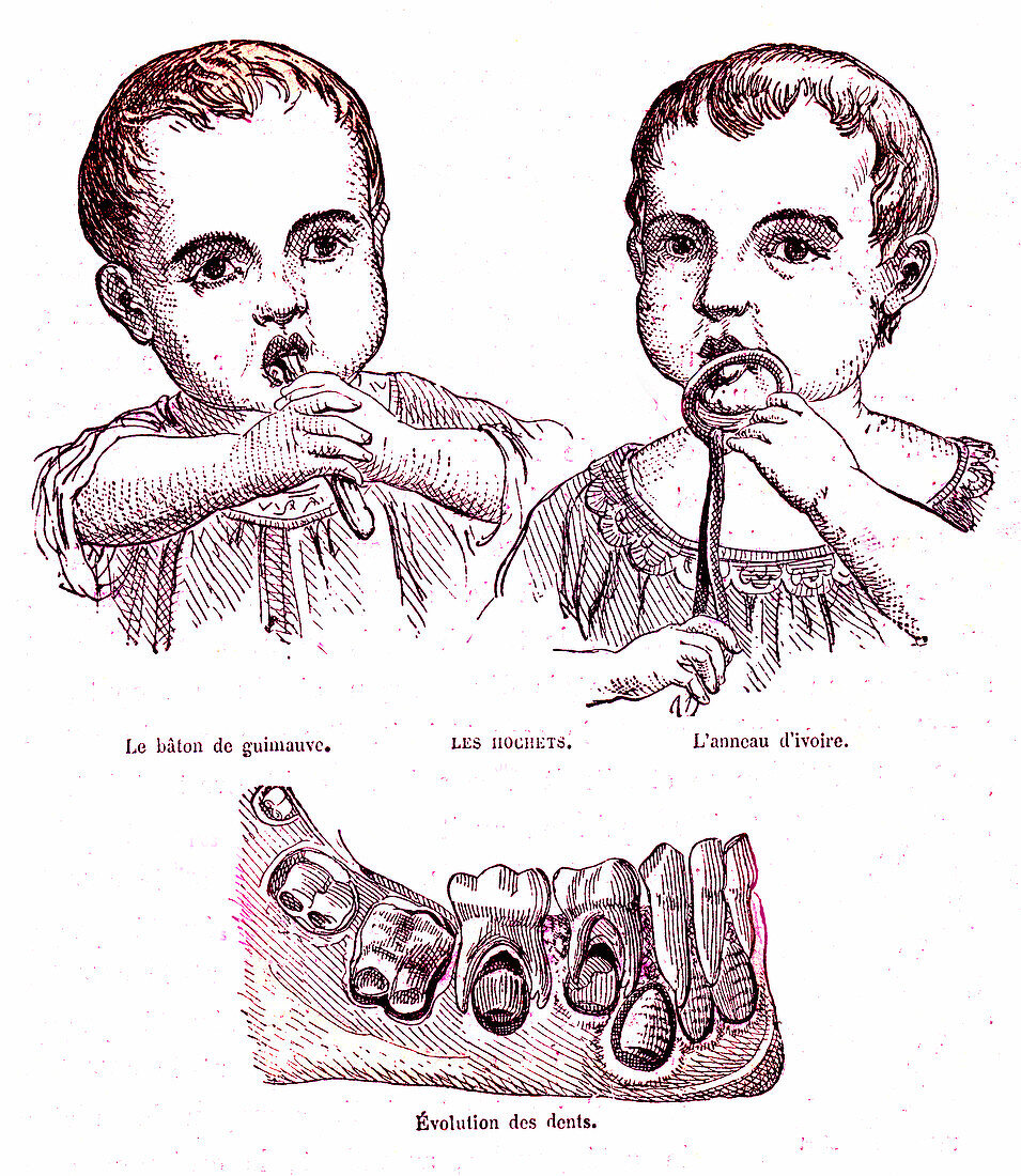 Teething and child teeth development, 19th century