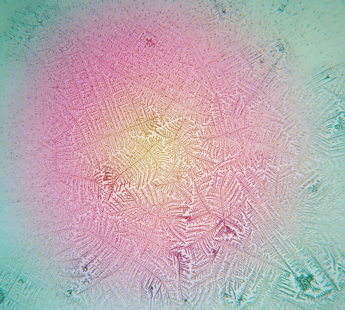 Human salivary ferning, light micrograph