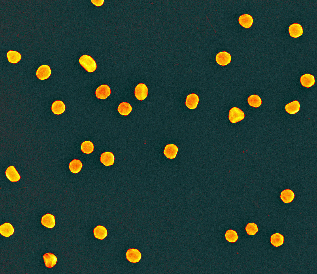 Gold nanoparticles, SEM