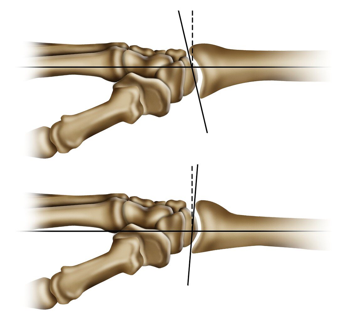 Wrist joint movements, illustration