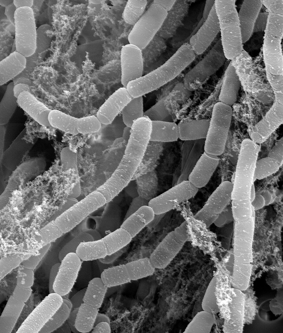 Streptomyces lydicus bacteria, SEM