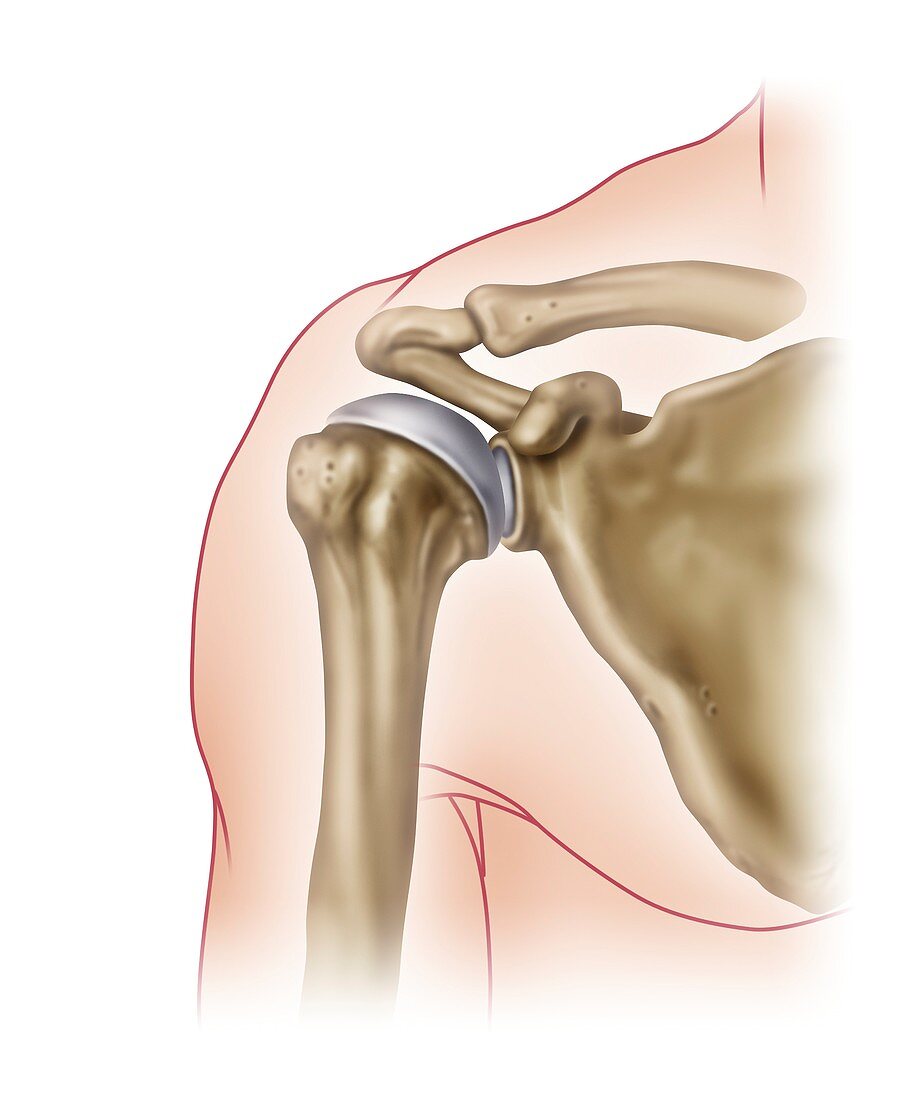 Shoulder joint anatomy, illustration