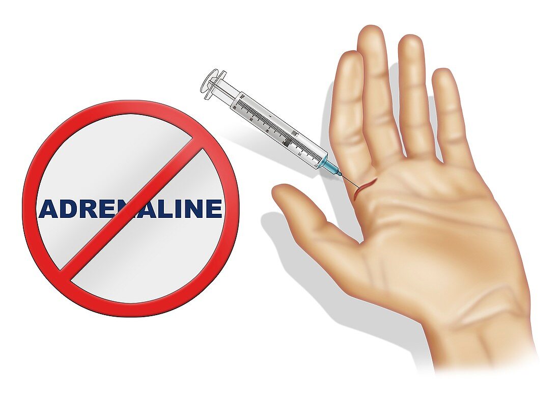 Use of adrenaline in woundcare, illustration