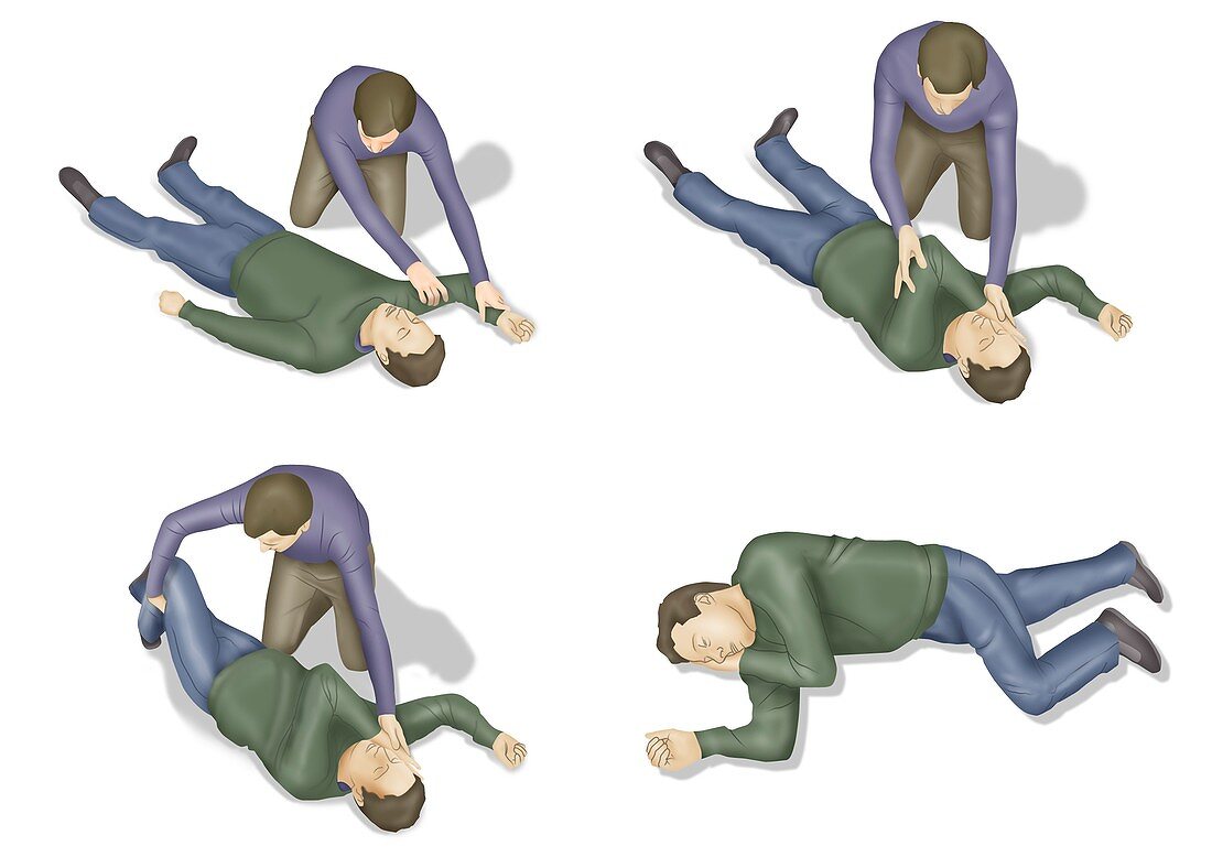 Recovery position, illustration