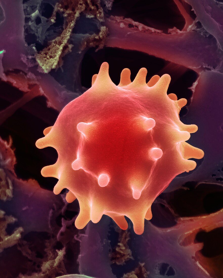 Crenate red blood cell, SEM