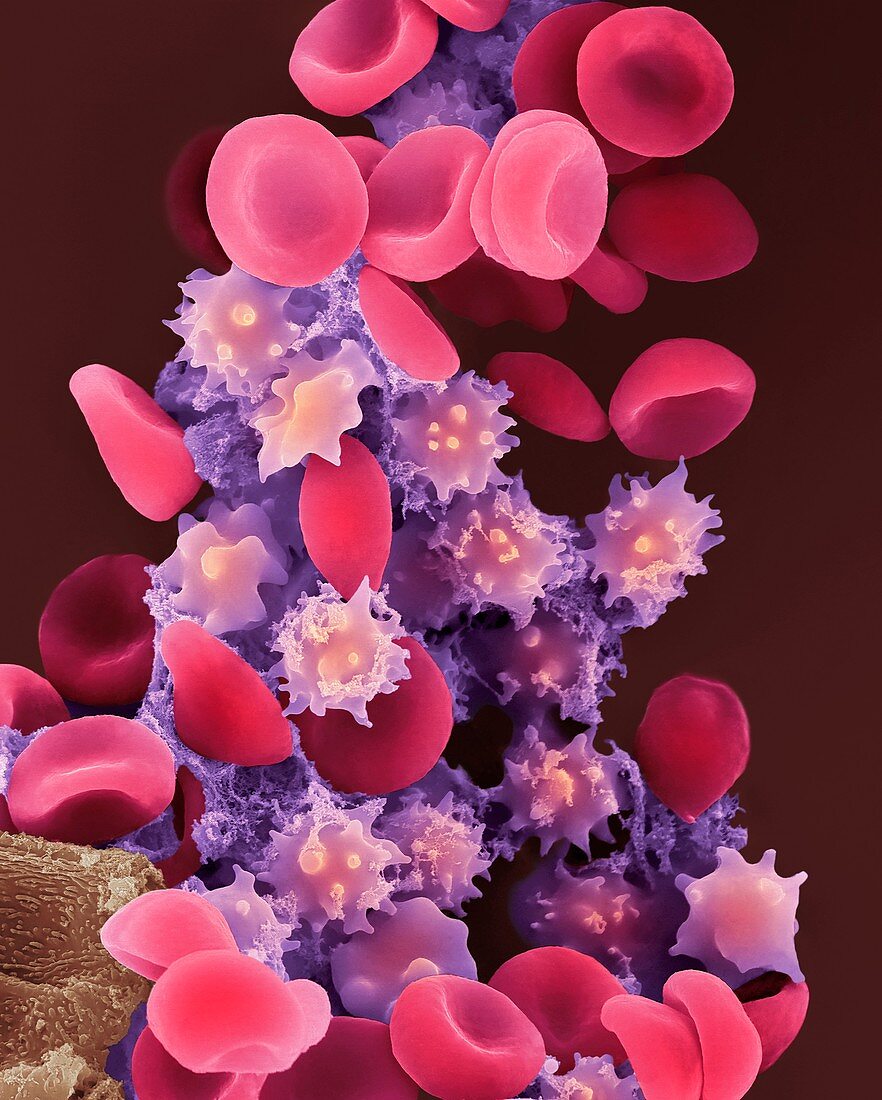Crenate red blood cells, SEM