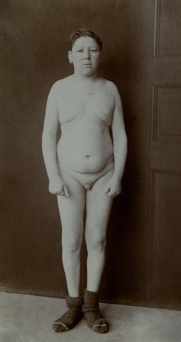Intersex person, historical image