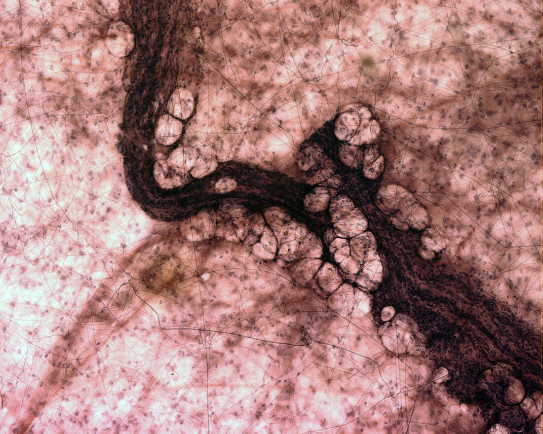 Areolar loose connective tissue, light micrograph