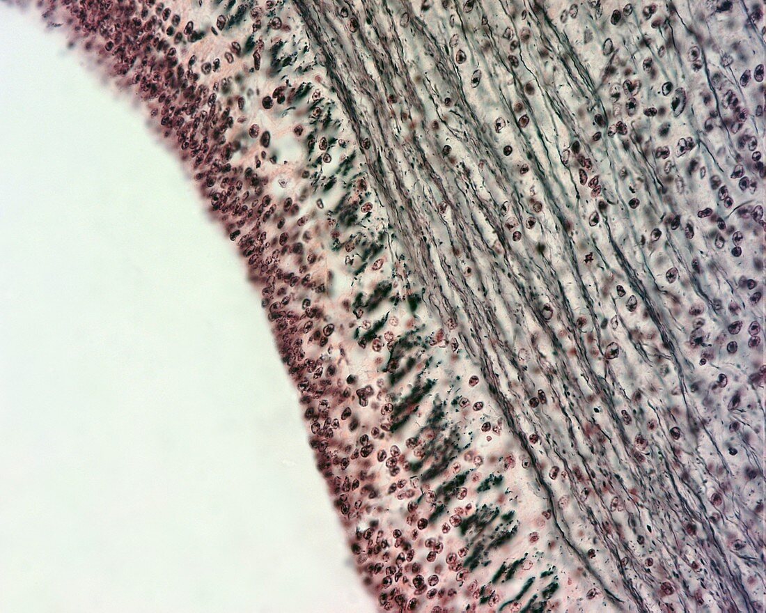Spinal cord nerve cells, light micrograph