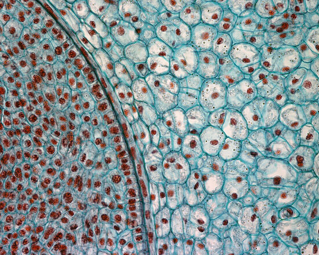 Section through flower ovary, light micrograph