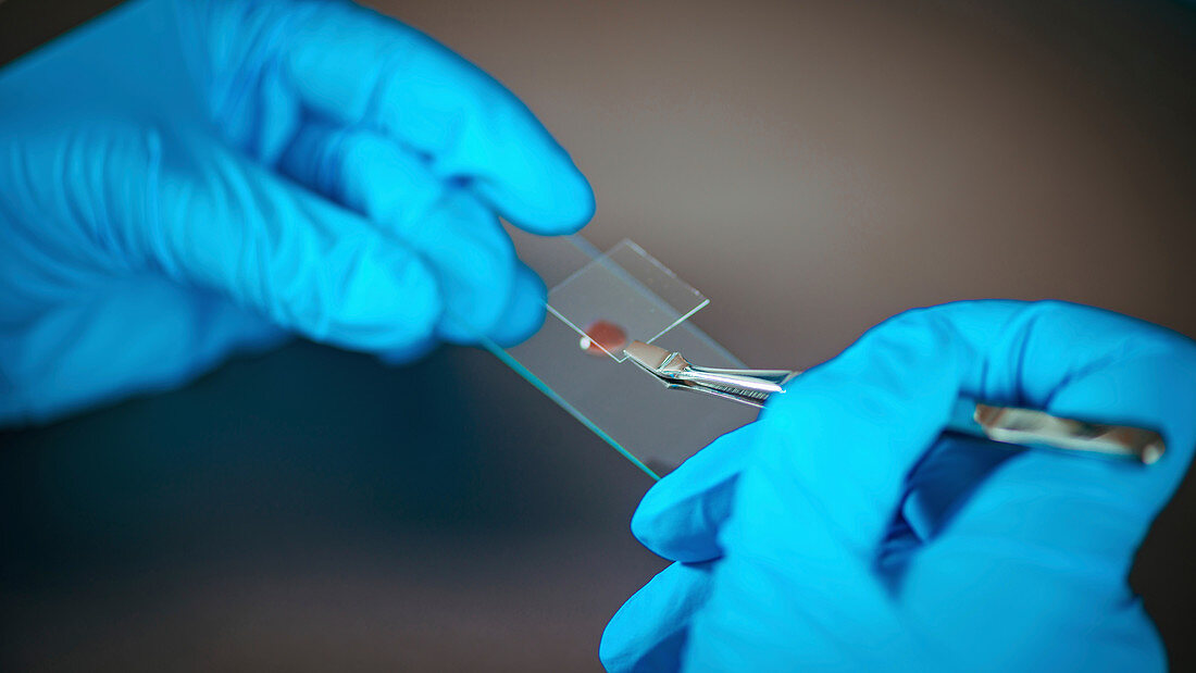 Scientist preparing microscope slide