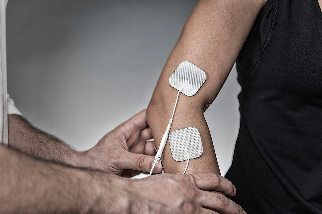 Placing TENS electrodes on arm