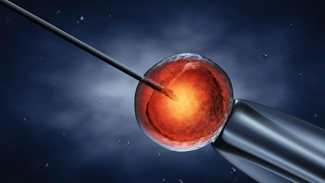 In vitro fertilization, illustration