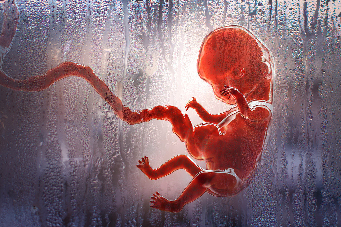 Abortion, conceptual illustration