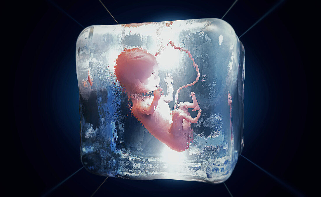 Frozen foetus, conceptual illustration