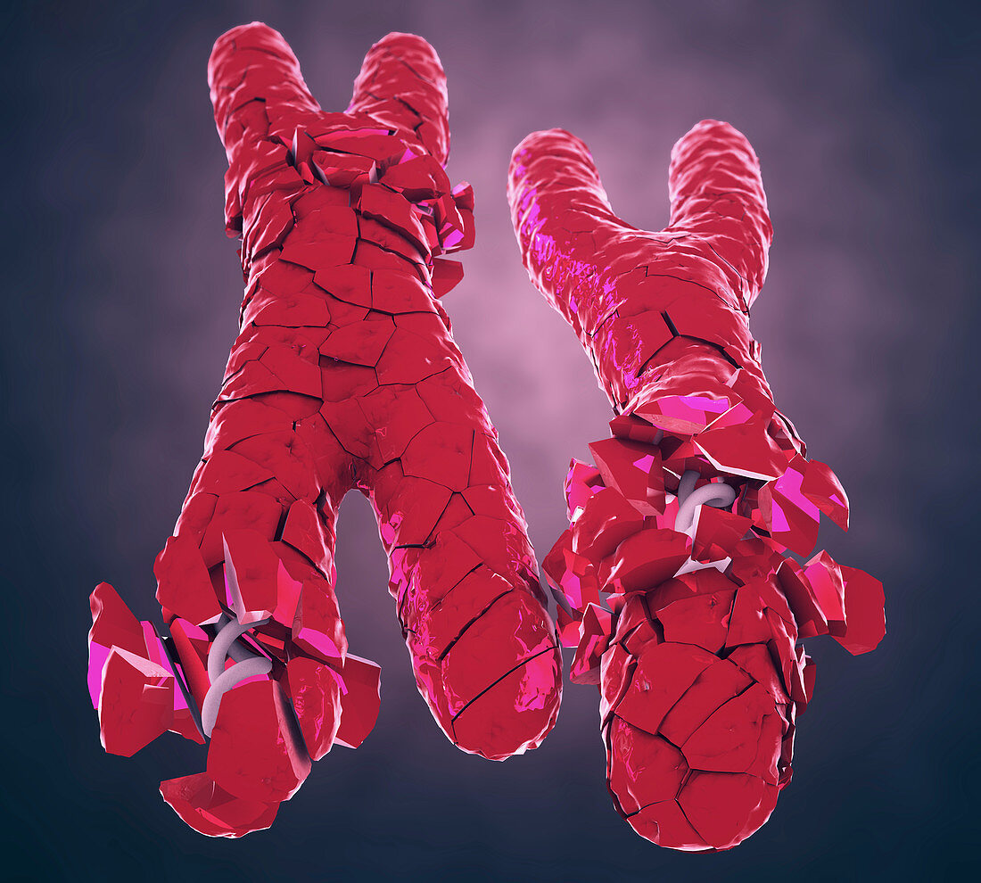 Defective X and Y chromosomes, illustration