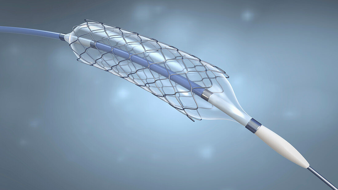 Stent and balloon catheter, illustration