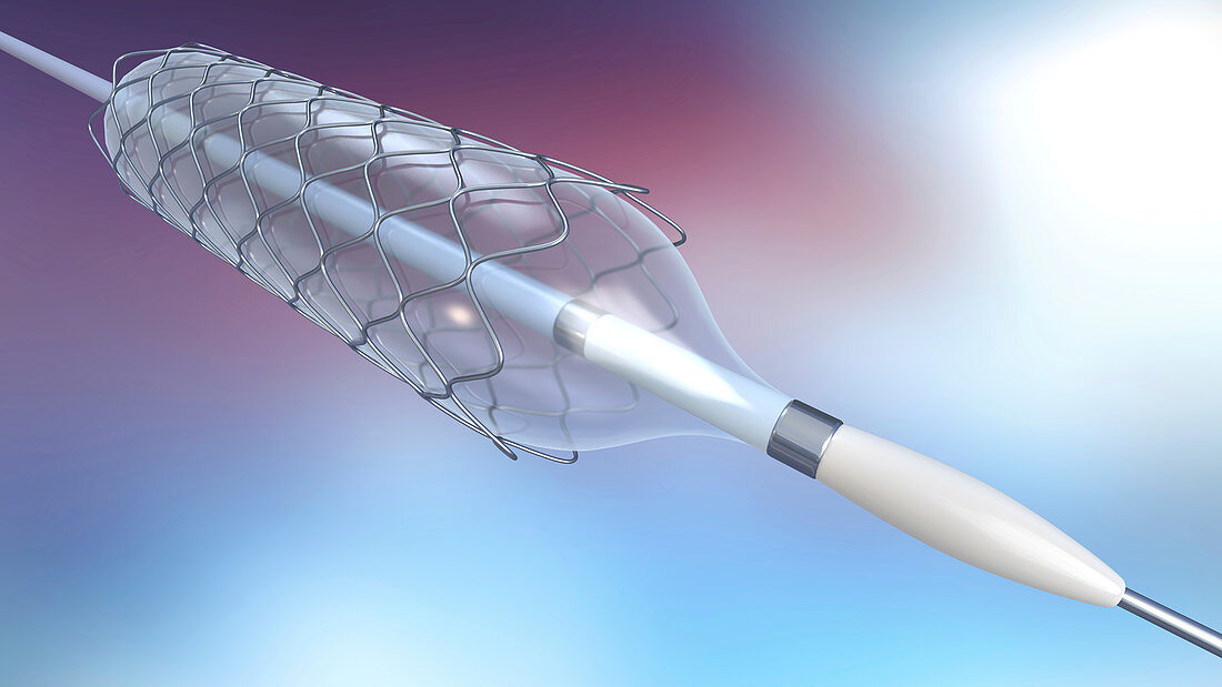 Stent and balloon catheter, illustration