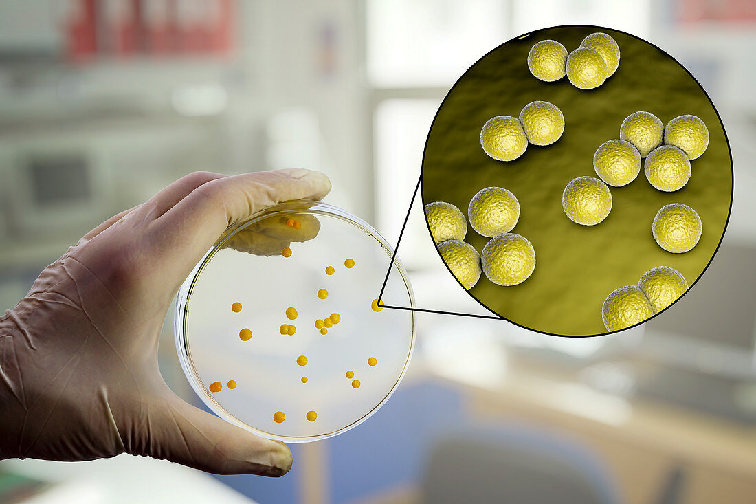 Micrococcus luteus bacteria, composite image