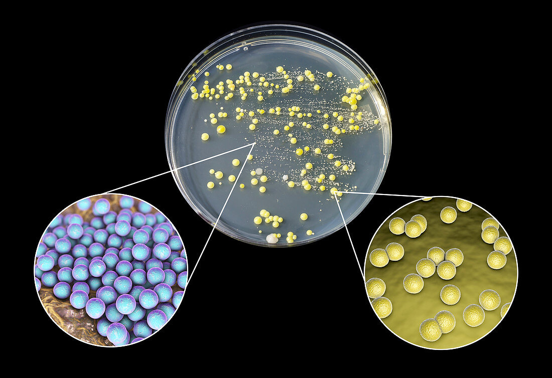 Bacterial culture grown from human skin, composite image