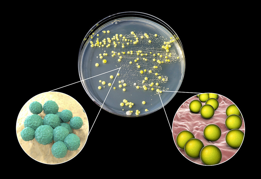 Bacterial culture grown from human skin, composite image