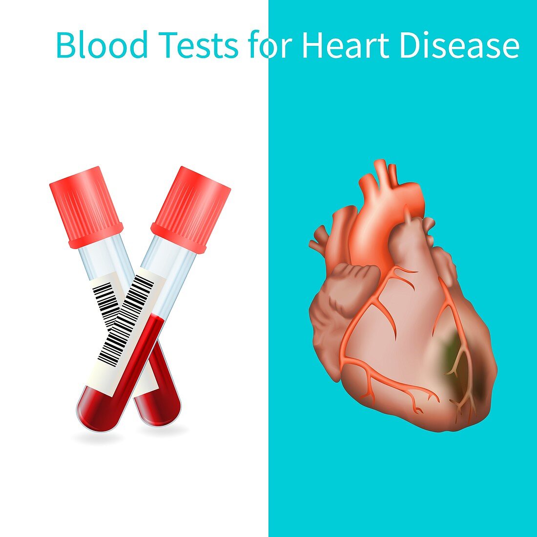 Blood tests for heart disease, illustration
