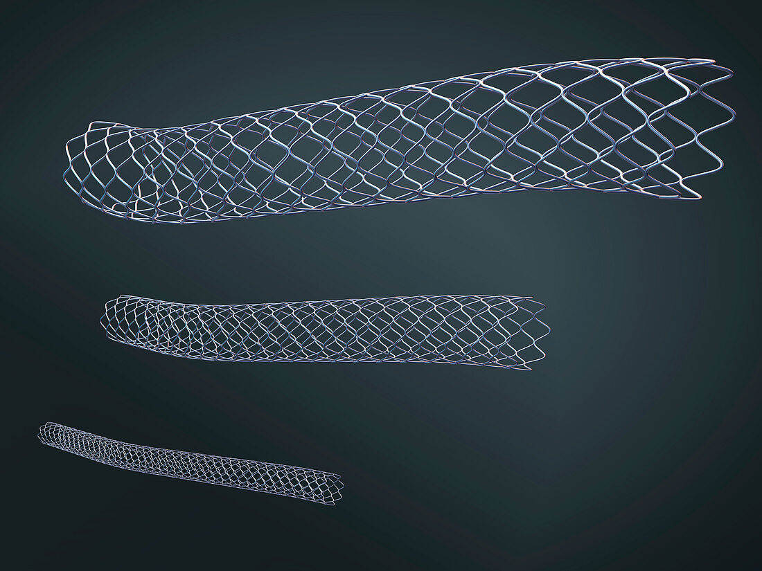 Stent, illustration