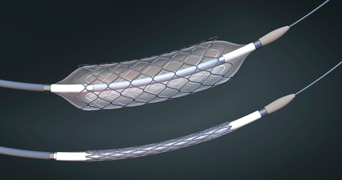 Stents and balloon catheters, illustration