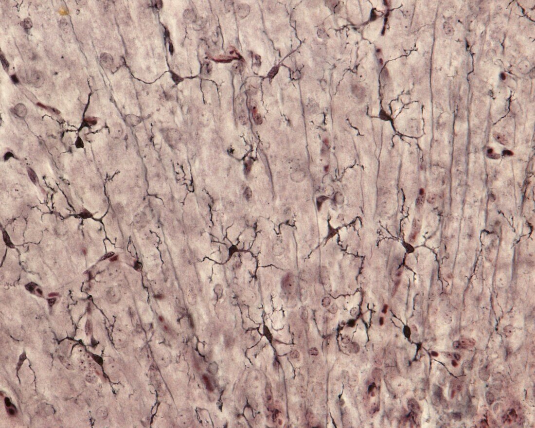Microglia, light micrograph
