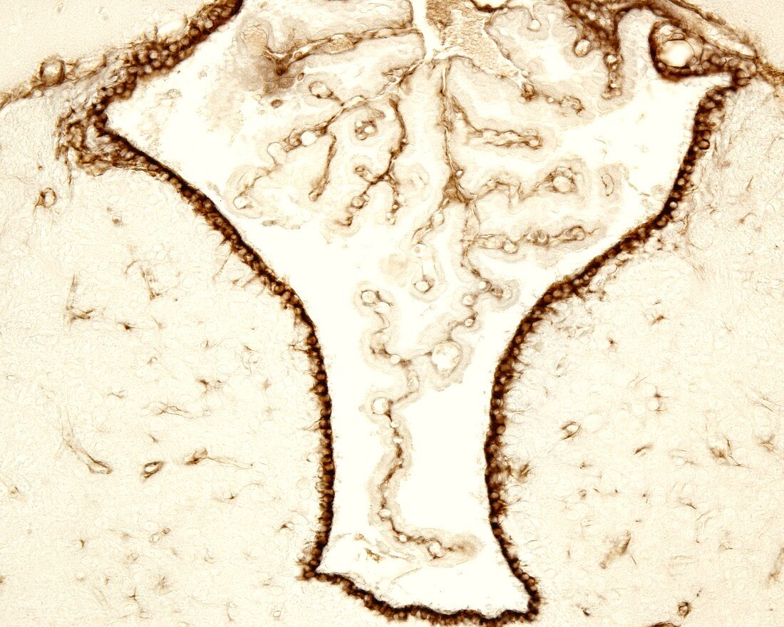 Brain third ventricle, light micrograph