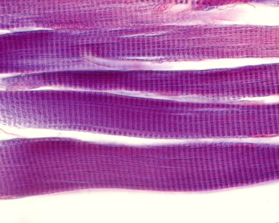 Striated skeletal muscle fibres, light micrograph