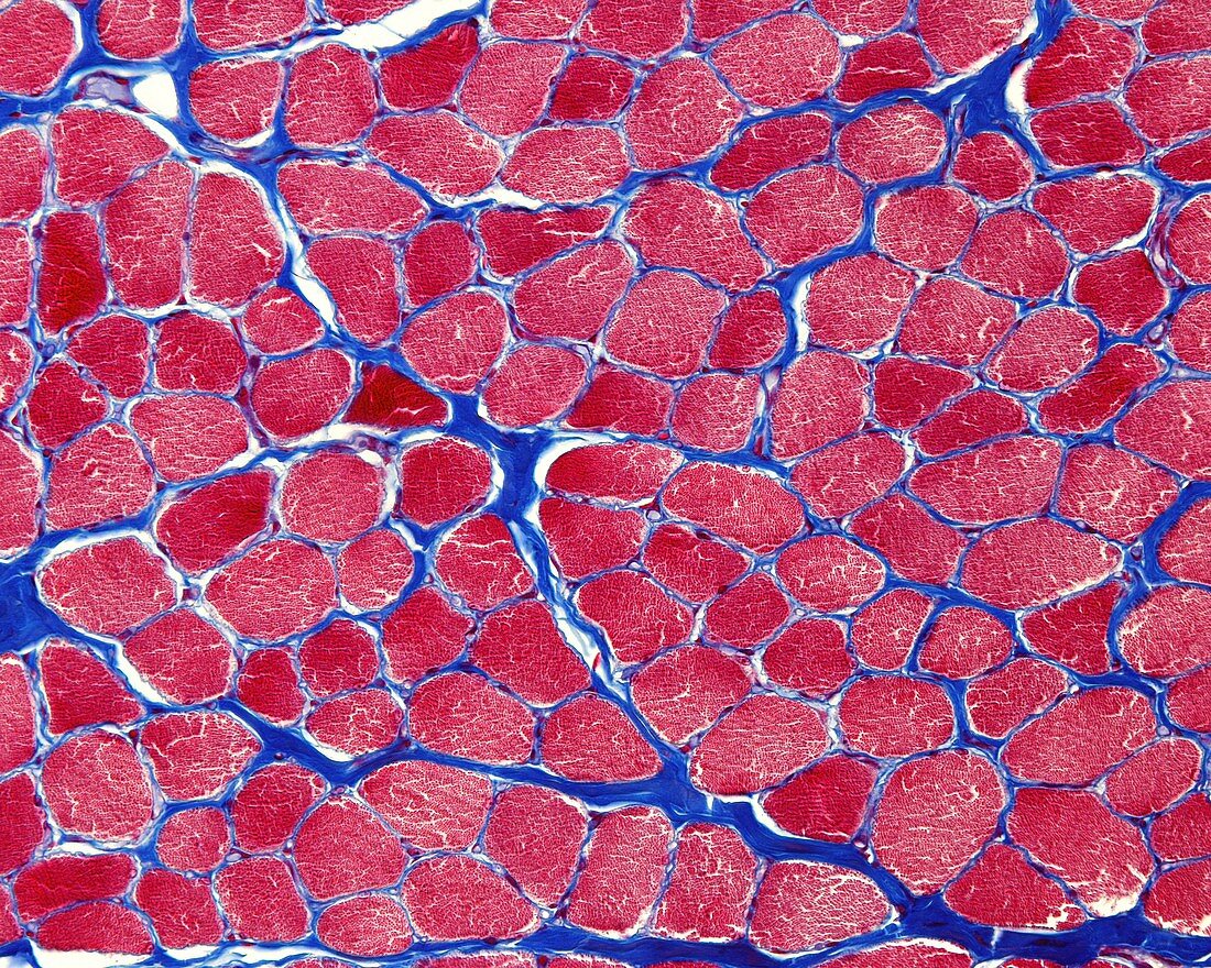 Skeletal striated muscle, light micrograph