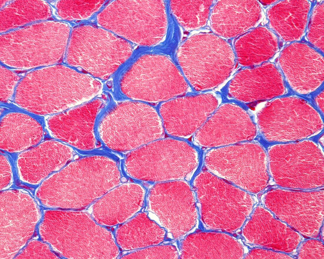 Skeletal striated muscle, light micrograph