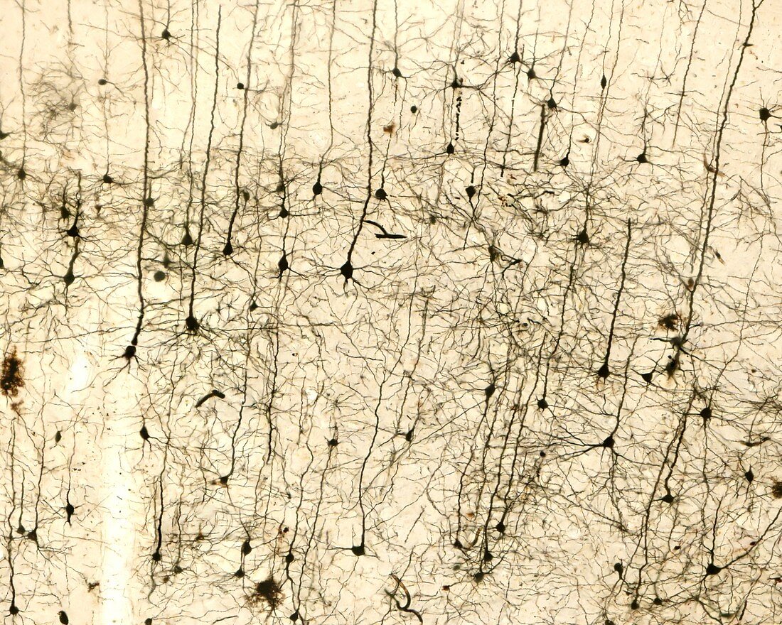 Cerebral cortex pyramidal cells, light micrograph
