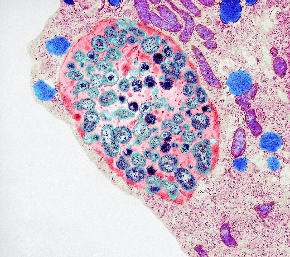 Chlamydia bacteria in a lung cell, TEM
