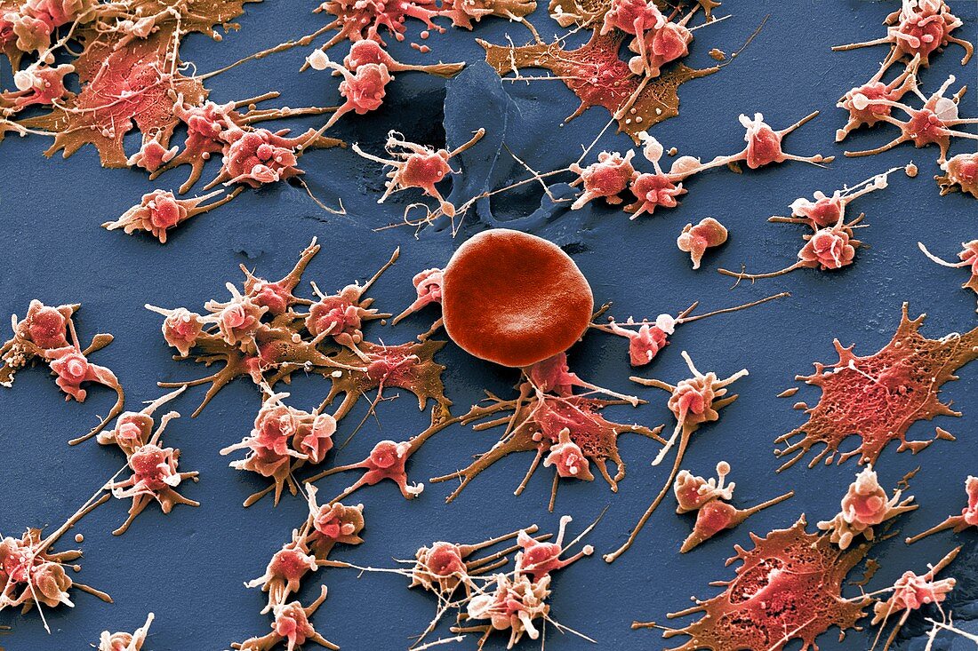 Red blood cell and platelets, SEM