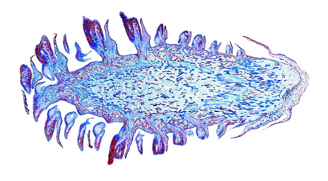 Pinus ovulate female cone, light micrograph