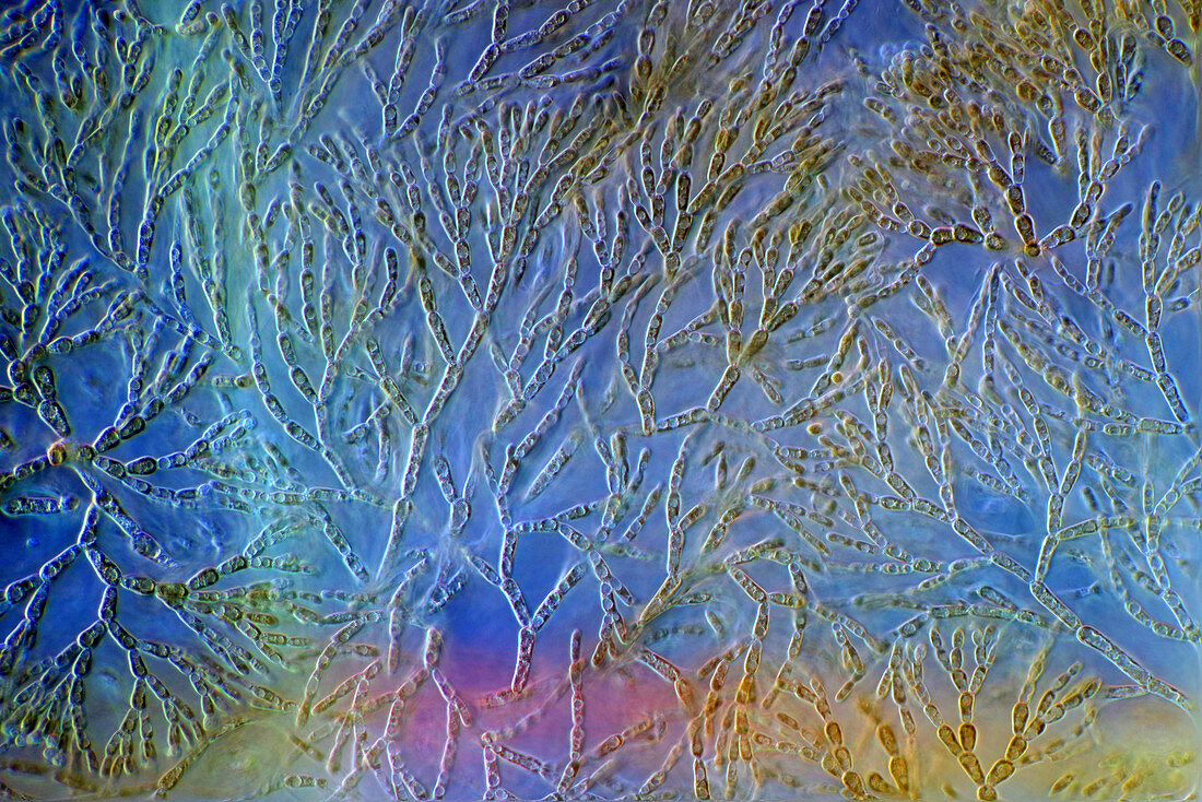 Batrachospermum alga cells, micrograph