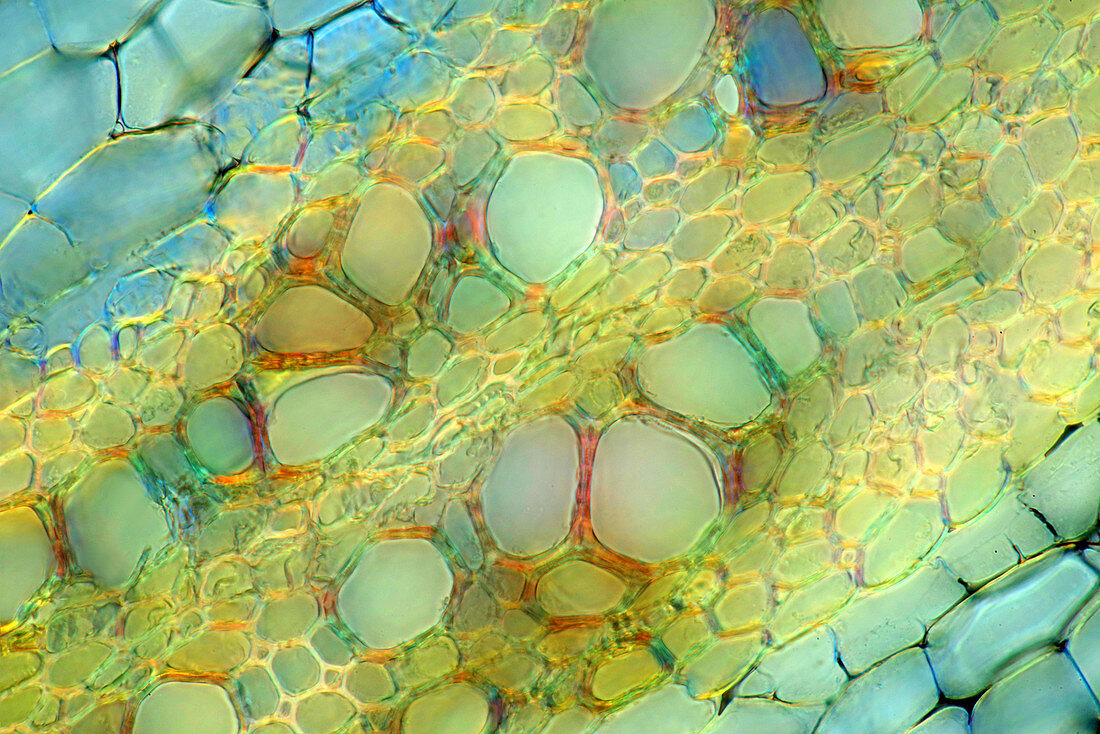 Broccoli, polarised light micrograph