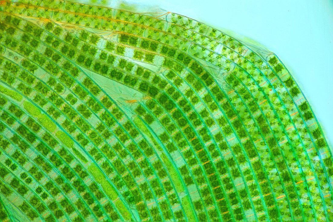 Mougeotia and Spirogyra filamentous algae , light micrograph