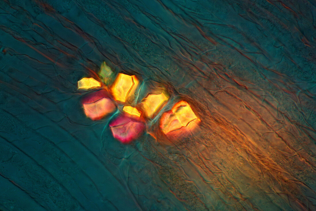 Crystals in lemon fruit, light micrograph
