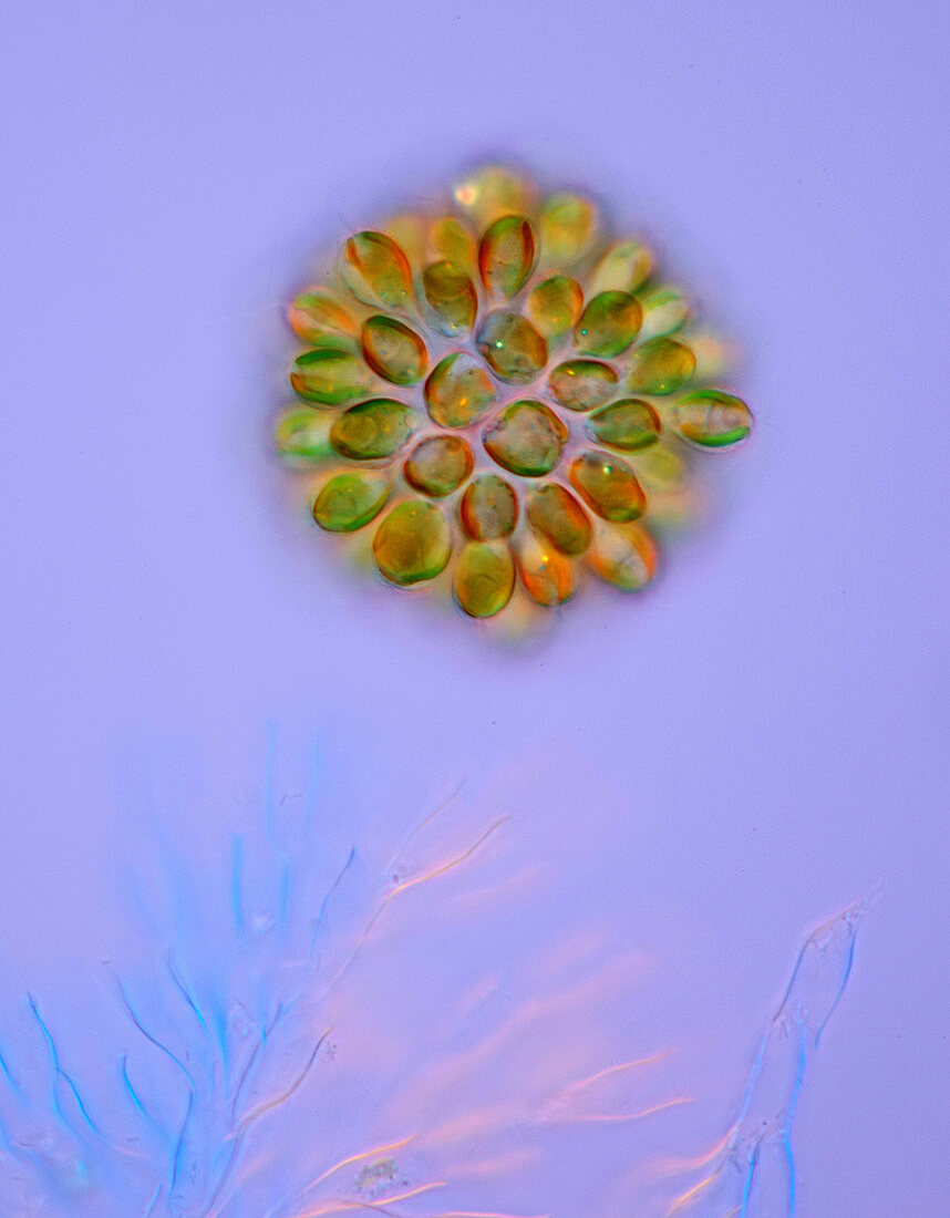 Synura uvella algae, light micrograph