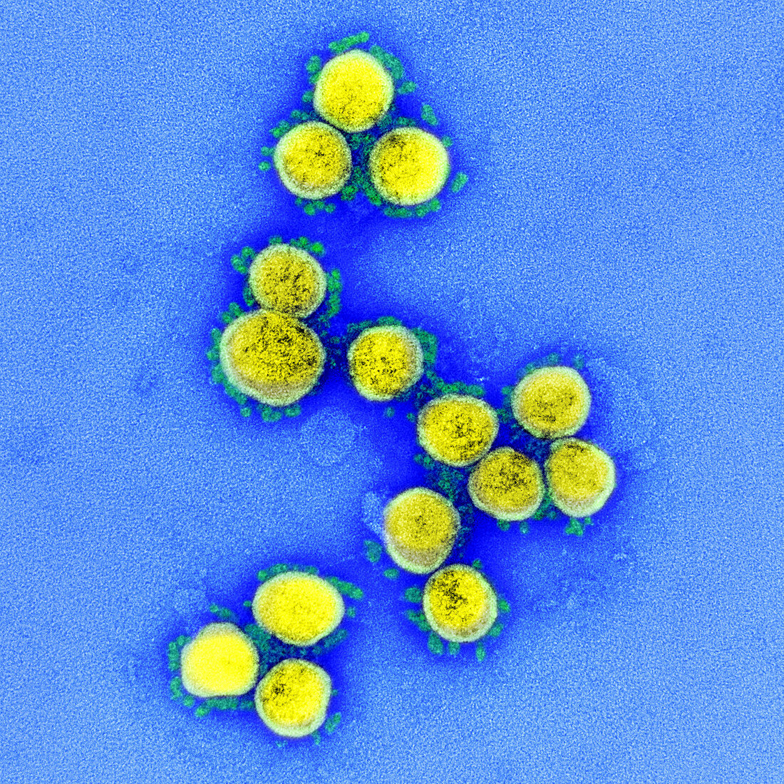 Covid-19 coronavirus, TEM