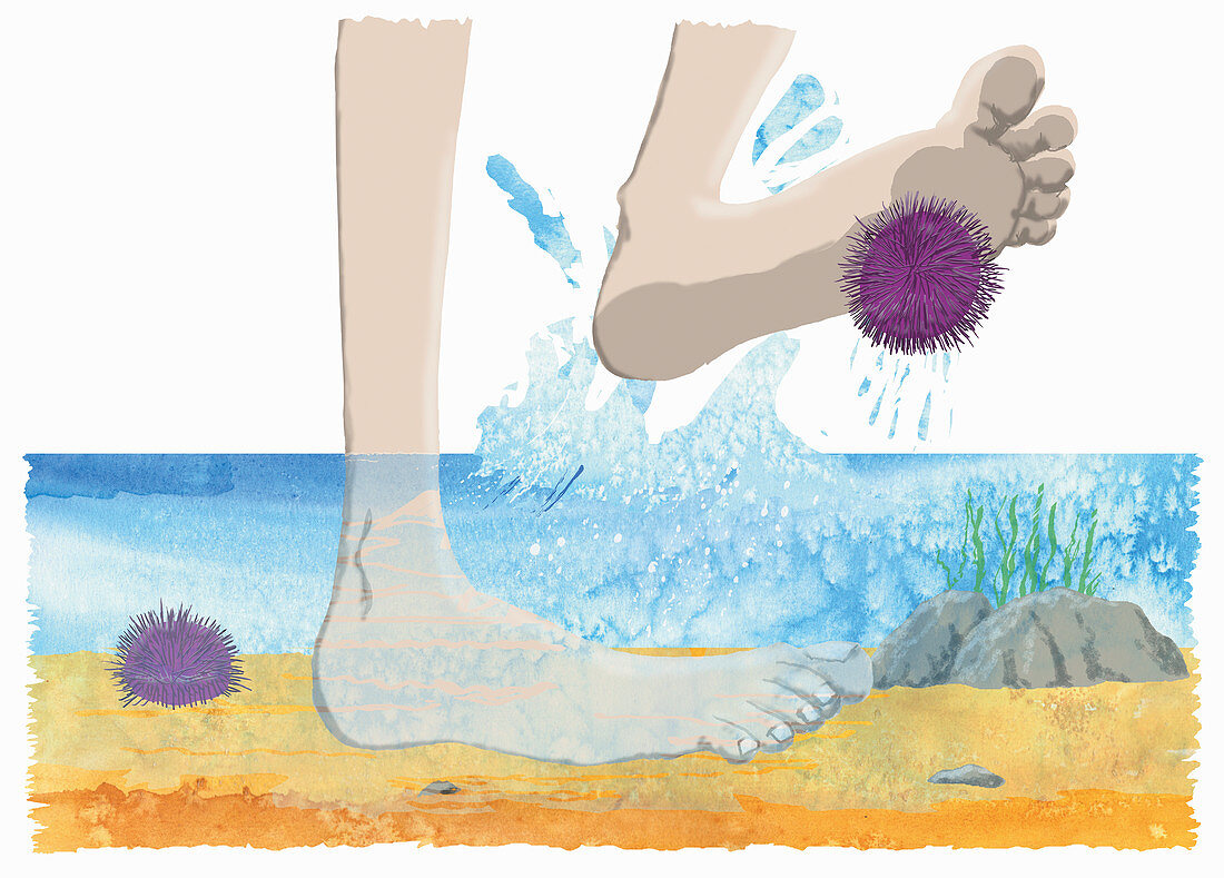 Standing on sea urchin, illustration
