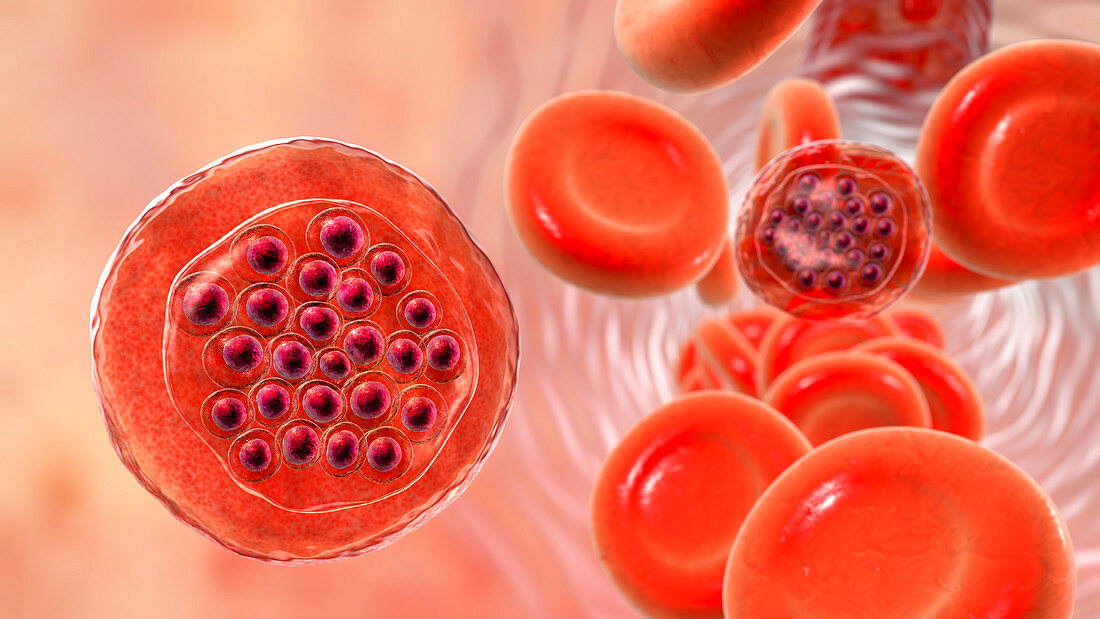 Plasmodium falciparum inside red blood cell, illustration