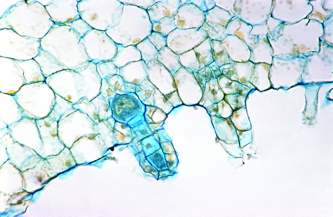 Fern female sex organ, light micrograph