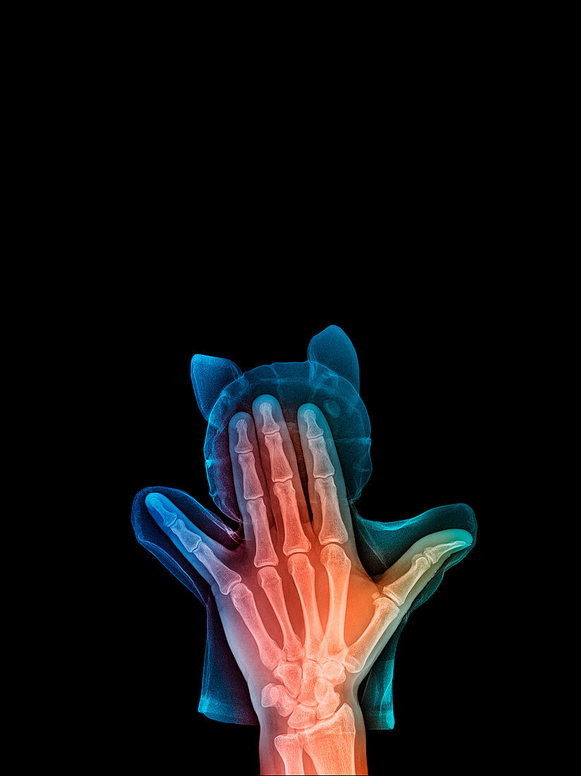 Hand puppet, X-ray